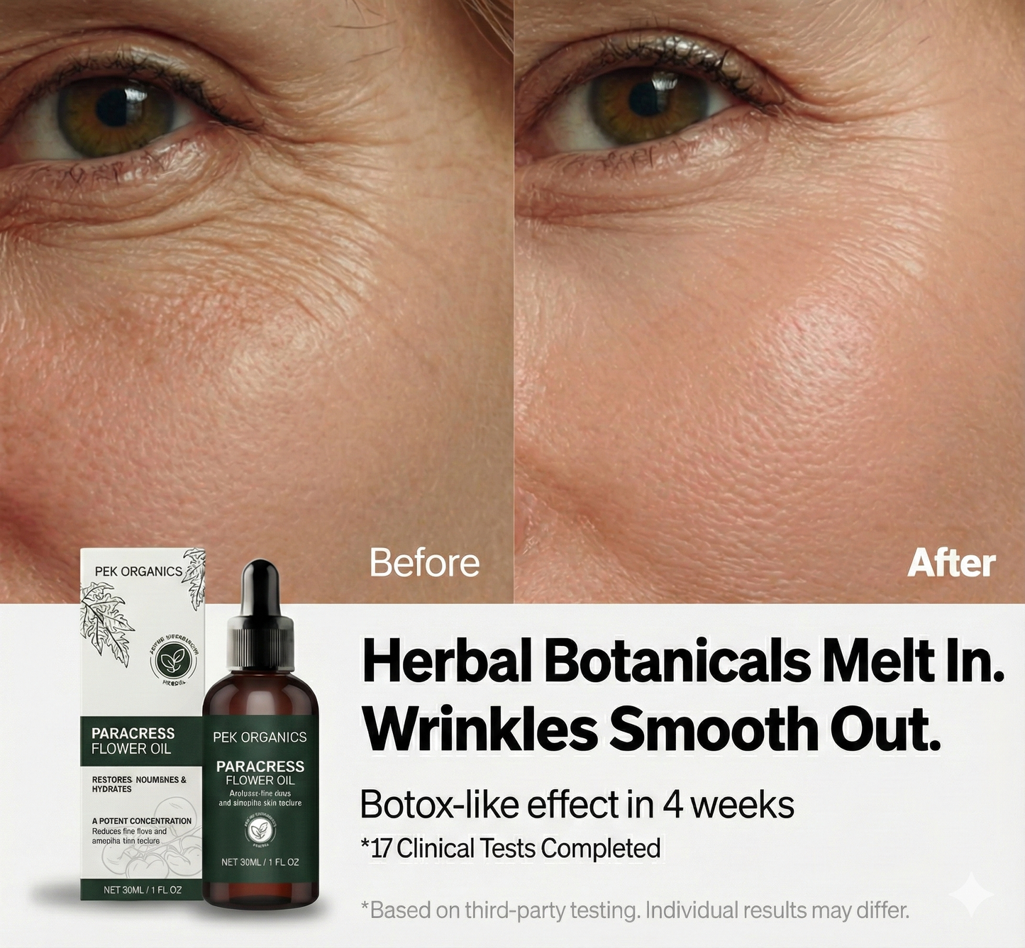 Nature's Botox - Paracress Anti-Aging Oil